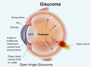 Glaucoma-Service