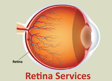 Retina-Service