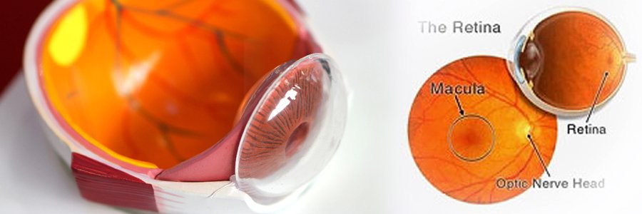 Retina